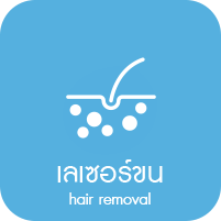 เลเซอร์ขน